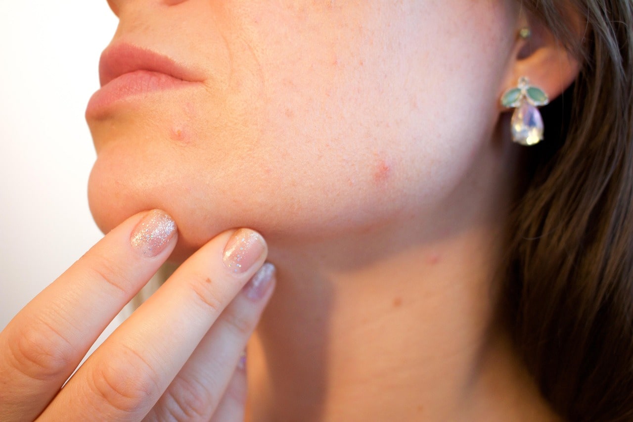 Luxuryderm Analyse peau et ses problemes