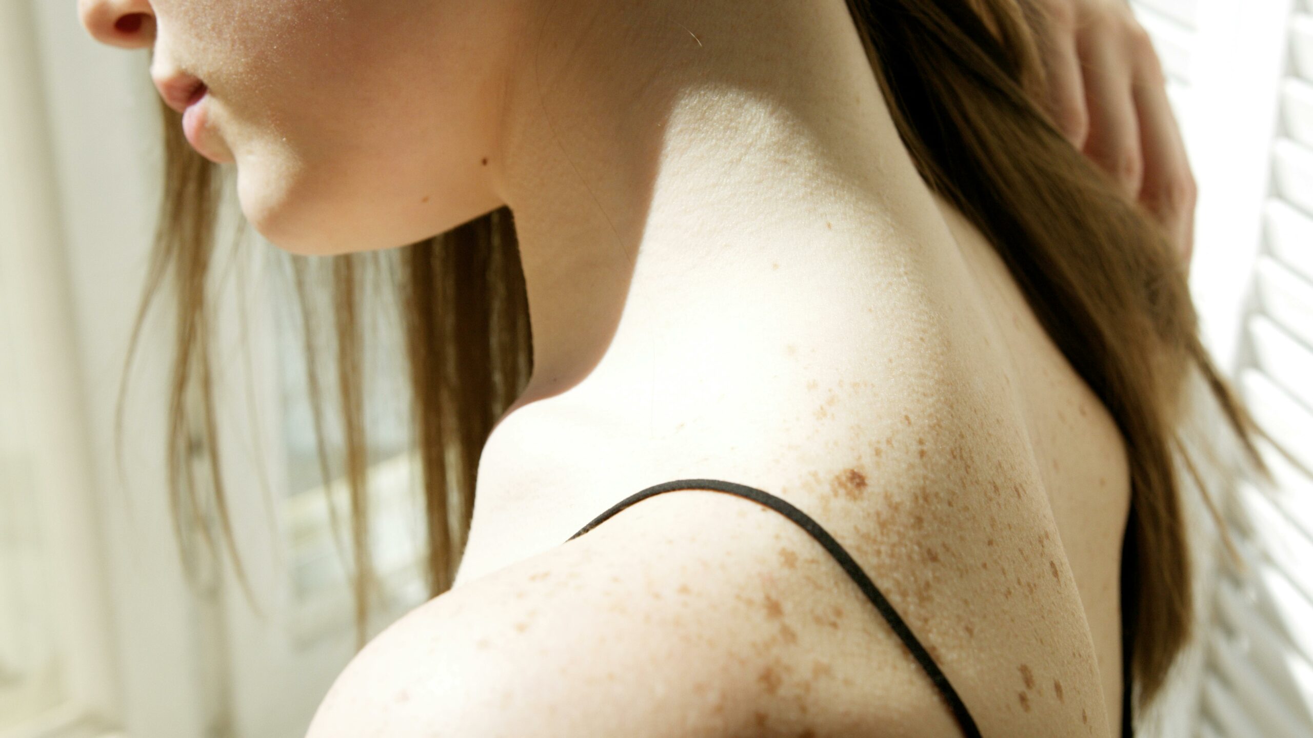 luxuryderm-traitement-taches-brunes-cannes-soins-luxe